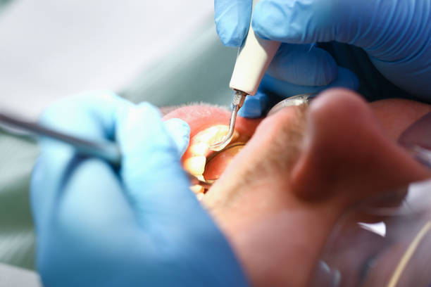 Best Walk-In Emergency Dentist in Villa Rica, GA